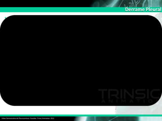 Derrame Pleural
Video Demostrativo de Pleurocentesis:
Video Demostrativo de Pleurocentesis. Youtobe. Trinsic Animation. 2015
 