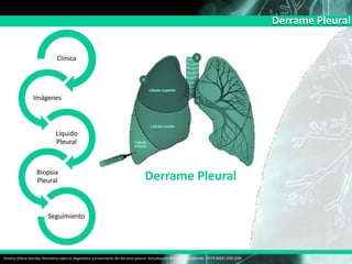 Derrame Pleural
Clínica
Imágenes
Líquido
Pleural
Biopsia
Pleural
Seguimiento
Derrame Pleural
Victoria Villena Garrido, Normativa sobre el diagnóstico y tratamiento del derrame pleural. Actualización Arch Bronconeumol. 2014;50(6):235–249
 