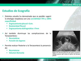Derrame Pleural
Estudios de Ecografía
 Distintos estudio ha demostrado que es posible sugerir
la etiología neoplásica con una sensibilidad 79% y 100%
especificidad.
 Engrosamiento pleural >1cm.
 Nodularidad Pleural
 Engrosamiento diafragmático >7mm
Victoria Villena Garrido, Normativa sobre el diagnóstico y tratamiento del derrame pleural. Actualización Arch Bronconeumol. 2014;50(6):235–249
 Así también disminuye las complicaciones de la
Toracocentesis:
 Neumotórax
 Punción de órganos
 Permite evaluar Posterior a la Torcacentesis la presencia
de:
 Neumotorax
 Volumen Remante
 