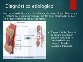 Diagnóstico etiológico
Muchos casos de derrames pleurales tendrán una etiología obvia, ya que
el enfermo suele presentar signos evidentes de su enfermedad de base,
en los casos donde no sea clara se realiza:
 Toracocentesis: obtención
de líquido pleural por
punción transtorácica,
permite clasificar el
derrame pleural en:
Exudado o trasudado.
 
