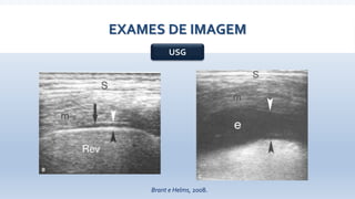 EXAMES DE IMAGEM
USG
Brant e Helms, 2008.
 