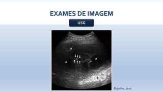 EXAMES DE IMAGEM
USG
Bugalho, 2010.
 
