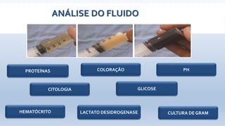 ANÁLISE DO FLUIDO
PROTEÍNAS
LACTATO DESIDROGENASE
PH
GLICOSECITOLOGIA
COLORAÇÃO
CULTURA DE GRAMHEMATÓCRITO
 