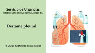 Servicio de Urgencias
Hospital General de Zona #30 Mexicali B.C
R1 UMQx Michelle N. Peraza Perales
Derrame pleural
 