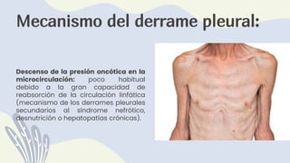 Mecanismo del derrame pleural:
Descenso de la presión oncótica en la
microcirculación: poco habitual
debido a la gran capacidad de
reabsorción de la circulación linfática
(mecanismo de los derrames pleurales
secundarios al síndrome nefrótico,
desnutrición o hepatopatías crónicas).
 