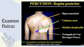 Examen
fisico:
 
