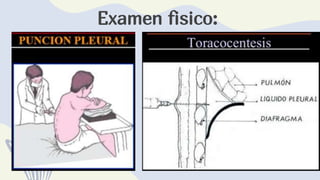 Examen fisico:
 