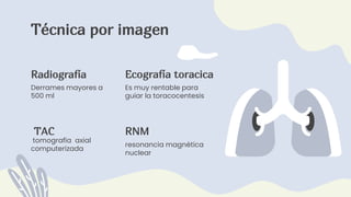 Técnica por imagen
Derrames mayores a
500 ml
tomografía axial
computerizada
Radiografía Ecografía toracica
TAC
Es muy rentable para
guiar la toracocentesis
resonancia magnética
nuclear
RNM
 