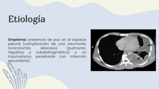 Etiología
Empiema: presencia de pus en el espacio
pleural (complicación de una neumonía,
toracotomía, abscesos (pulmonar,
hepático o subdiafragmático) o un
traumatismo penetrante con infección
secundaria).
 