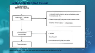 Evaluacion Derrame Pleural
Herrera-Garcia, Jose Carlos. Sanchez-Perez, Ruben. Derrame pleural: ruta diagnostica inicial. Med Int Mex. 2015;31:181-190
 
