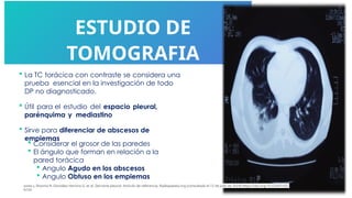 ESTUDIO DE
TOMOGRAFIA
 La TC torácica con contraste se considera una
prueba esencial en la investigación de todo
DP no diagnosticado.
 Útil para el estudio del espacio pleural,
parénquima y mediastino
 Sirve para diferenciar de abscesos de
empiemas
 Considerar el grosor de las paredes
 El ángulo que forman en relación a la
pared torácica
 Angulo Agudo en los abscesos
 Angulo Obtuso en los empiemas
jones J, Sharma R, González Herrera G, et al. Derrame pleural. Artículo de referencia, Radiopaedia.org (consultado el 12 de julio de 2024) https://doi.org/10.53347/rID-
6159
 