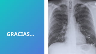 GRACIAS…
 