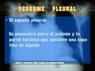 DERRAME

PLEURAL

• El espacio pleur al:
Se encuentra entr e el pulmón y la
par ed torácica que contiene una capa
fina de liquido

Ligtht R., Harrinson 2006, tratado de medicina interna

 