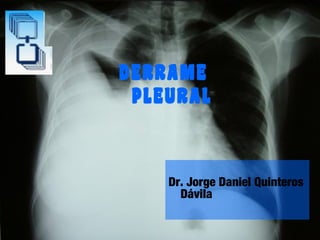 DERRAME
PLEURAL

Dr. Jorge Daniel Quinteros
Dávila

 