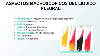 ASPECTOS MACROSCOPICOS DEL LIQUIDO
PLEURAL
 