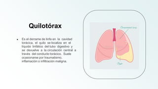 ● Es el derrame de linfa en la cavidad
torácica, el quilo se localiza en el
líquido linfático del tubo digestivo y
se devuelve a la circulación central a
través del conducto torácico. Suele
ocasionarse por traumatismo,
inflamación o infiltración maligna.
Quilotórax
 