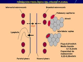 Derrame Pleural Flujo-0,01ml/k/h Media liquido 0,1-0,2ml/k Capacidad de reabsorción 0,22-0,28ml/k/h FORMACION FISIOLOGICA ...