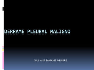 DERRAME PLEURAL MALIGNO
GIULIANA SAMAMEAGUIRRE
 