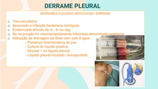 DERRAME PLEURAL
DERRAMES PLEURAIS INFECCIOSO / EMPIEMA
o Tipo exsudativo
o Associado a infecção bacteriana contíguas
o Evidenciada através de rx , tc ou usg
o Se na punção for macroscopicamente infeccioso denominado empiema
o Indicação de drenagem de tórax com selo d´agua
- Presença macroscópica de pus
- Cultura do líquido positiva
- Glicose + no liquido pleural
- Líquido pleural loculado / encapsulado
 