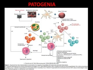 PATOGENIA
L. Ferreiro et al / Arch Bronconeumol. 2014;50(10):435–443
 