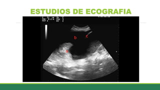 ESTUDIOS DE ECOGRAFIA
 