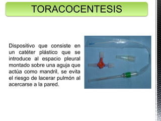 Dispositivo que consiste en
un catéter plástico que se
introduce al espacio pleural
montado sobre una aguja que
actúa como mandril, se evita
el riesgo de lacerar pulmón al
acercarse a la pared.
TORACOCENTESIS
 