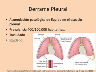 Derrame Pleural
• Acumulación patológica de líquido en el espacio
pleural.
• Prevalencia 400/100,000 habitantes.
• Trasudado
• Exudado
Harrison´s Principles of internal medicine, 17 ed, Disorders of the pleura and mediatinum, cap 257, pp 1658-1661
 