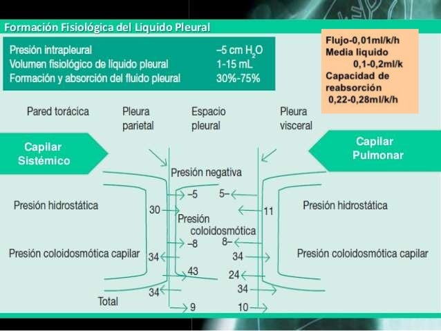 Protocolo Diagnostico Del Derrame Pleural Sciencedirect