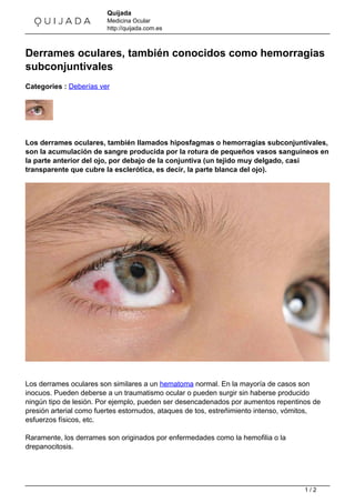 Quijada 
Medicina Ocular 
http://quijada.com.es 
Derrames oculares, también conocidos como hemorragias 
subconjuntivales 
Categories : Deberías ver 
Los derrames oculares, también llamados hiposfagmas o hemorragias subconjuntivales, 
son la acumulación de sangre producida por la rotura de pequeños vasos sanguíneos en 
la parte anterior del ojo, por debajo de la conjuntiva (un tejido muy delgado, casi 
transparente que cubre la esclerótica, es decir, la parte blanca del ojo). 
Los derrames oculares son similares a un hematoma normal. En la mayoría de casos son 
inocuos. Pueden deberse a un traumatismo ocular o pueden surgir sin haberse producido 
ningún tipo de lesión. Por ejemplo, pueden ser desencadenados por aumentos repentinos de 
presión arterial como fuertes estornudos, ataques de tos, estreñimiento intenso, vómitos, 
esfuerzos físicos, etc. 
Raramente, los derrames son originados por enfermedades como la hemofilia o la 
drepanocitosis. 
1 / 2 
 