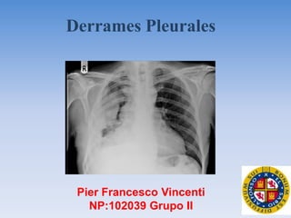 Derrames Pleurales
Pier Francesco Vincenti
NP:102039 Grupo II
 