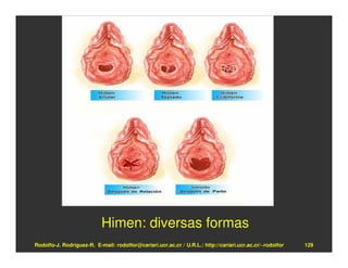 Himen: diversas formas
Rodolfo-J. Rodríguez-R. E-mail: rodolfor@cariari.ucr.ac.cr / U.R.L.: http://cariari.ucr.ac.cr/~rodolfor   129
 