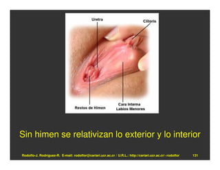 Sin himen se relativizan lo exterior y lo interior

Rodolfo-J. Rodríguez-R. E-mail: rodolfor@cariari.ucr.ac.cr / U.R.L.: http://cariari.ucr.ac.cr/~rodolfor   131
 