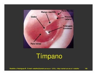 Tímpano
Rodolfo-J. Rodríguez-R. E-mail: rodolfor@cariari.ucr.ac.cr / U.R.L.: http://cariari.ucr.ac.cr/~rodolfor   199
 