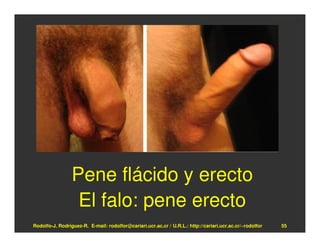 Pene flácido y erecto
                  El falo: pene erecto
Rodolfo-J. Rodríguez-R. E-mail: rodolfor@cariari.ucr.ac.cr / U.R.L.: http://cariari.ucr.ac.cr/~rodolfor   55
 