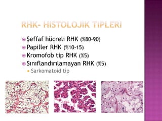  Şeffaf

hücreli RHK (%80-90)
 Papiller RHK (%10-15)
 Kromofob tip RHK (%5)
 Sınıflandırılamayan RHK (%5)


Sarkomatoid tip

 