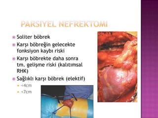 Soliter böbrek
 Karşı böbreğin gelecekte
fonksiyon kaybı riski
 Karşı böbrekte daha sonra
tm. gelişme riski (kalıtımsal
RHK)
 Sağlıklı karşı böbrek (elektif)





<4cm
<7cm

 