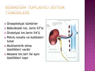 Üroepitelyal tümörler
 Böbrekteki tm. lerin %7’si
 Ürotelyal tm.lerin %4’ü
 Pelvis renalis ve kaliksleri
tutar
 Multisentrik olma
özellikleri vardır
 Mesane tm.leri ile aynı
özellikleri taşır


 