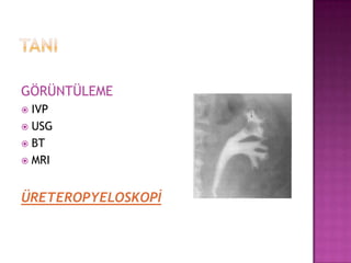 GÖRÜNTÜLEME
IVP
 USG
 BT
 MRI


ÜRETEROPYELOSKOPİ

 