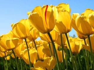 Ders böbrek yeni tm.