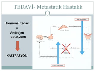 TEDAVİ- Metastatik Hastalık
Hormonal tedavi
=
Androjen
ablasyonu

KASTRASYON

 