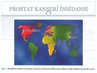 PROSTAT KANSERİ İNSİDANSI

 