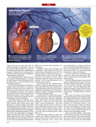 Titel




                                                                                                                                                     DO C-STO CK
   Natürlicher Bypass
   Überbrückung von Gefäßverengungen
   durch Arteriogenese




                                       verengte Arterie                                                                                  Dieser
                                                                                                                                   Prozess soll künftig
                                                                                                                                       durch neue
                                                                                                                                  Therapien und Medi-
                                                                                                                                    kamente gezielt
                                                                                                                                        gefördert
                                                                                                                                        werden.



            Arterie
                                                                                     verengte
                                                                                     Arterie



                      Kollaterale


     Das Blut ﬂießt durch größere Arterien,            Wenn sich eine größere Arterie                Der Blutﬂuss bewirkt eine Umwandlung
  die durch kleine Brückengefäße (Kollate-          verengt, wird das Blut zunehmend              der Kollateralen in große Arterien. Die Eng-
  ralen) verbunden sind. In diesen ist der          durch die Kollateralen gelenkt.               stelle wird so überbrückt und das Gewebe
  Blutﬂuss sehr gering.                                                                           wieder ausreichend mit Blut versorgt.


lungen hat sich seit 1990 auf mehr als           Mehr als 40 Prozent der Deutschen ster-            menschliche Herz, so zeigt sich deutlich,
325 000 Eingriffe verzehnfacht. Und zu           ben daran.                                         kann verstopfte Gefäße überbrücken, in-
den größten Blockbustern der pharma-                Namhafte Ärzte fordern deshalb ein              dem es um Engstellen herum Umleitun-
zeutischen Industrie gehören Medikamen-          Umdenken – und können sich dabei auf               gen wachsen lässt – wie von Zauberhand
te gegen Cholesterin; sie werden mittler-        faszinierende Erkenntnisse aus der For-            entstehen so natürliche Bypässe.
weile von schätzungsweise vier Millionen         schung berufen: Selbst dem bereits er-                Gestärkt werden die selbstheilenden
Bundesbürgern geschluckt.                        krankten Herzen wohnt noch die Fähig-              Adern vor allem durch Bewegung. Wer
   Die Erfolgsgeschichte scheint sich in         keit inne, sich selbst zu heilen. Diese            Sport treibt, lässt die körpereigenen By-
den Zahlen widerzuspiegeln. Die Zahl             Selbstheilungskraft wollen die Pioniere            pässe sprießen.
der Infarkttoten in Deutschland geht Jahr        wecken – und so eine Revolution in der                Doch die Medizinpioniere bauen nicht
für Jahr zurück – sie ist seit 1980 um fast      Herztherapie einleiten.                            allein auf gesunden Lebensstil. Auch fu-
die Hälfte gesunken.                                Derzeit betreibt die Hochleistungs-             turistisch erscheinende Apparate wie eine
   Das alles nährt die Illusion, Herzerkran-     medizin vielfach nur Reparaturen, wenn-            an der Berliner Charité entwickelte
kungen seien inzwischen ein technisch            gleich auf hohem Niveau, und rettet Tau-           „Herz-Hose“ sollen zur Bildung der Bio-
lösbares Problem, die Ärzte würden es            senden Menschen das Leben. Die lebens-             Bypässe beitragen. Andere Forscher fahn-
schon richten. In Wahrheit werden viele          gefährliche Verkalkung der Herzkranz-              den bereits nach Medikamenten, die das
der Behandelten niemals mehr gesund.             gefäße zu heilen, das gelingt mit Stents           wundersame Gefäßwachstum fördern
Der größte Feind des Herzens, die Durch-         und Pillen allerdings nicht.                       sollen.
blutungsstörungen seiner Gefäße, lässt              Gerhard Schuler, Direktor des Leipzi-              Wie kaum ein Zweiter hat Erdmann
sich durch chirurgische Eingriffe und teu-       ger Herzzentrums, vergleicht das Dilem-            Glanz und Elend der Herzmedizin miter-
re Medikamente nicht aufhalten.                  ma mit einem Auto, das einen Rostfleck             lebt. Während Dietmar K. im OP der Köl-
   Tatsächlich bleibt die Zahl der Herz-         trägt. „Wir können die Stelle ordentlich           ner Uniklinik mit einer Vibrationssäge
kranken hoch. Während die Zahl töd-              lackieren, so dass man sie nicht mehr              der Brustkorb geöffnet wird, hat sich der
licher Infarkte sinkt, sterben heute viele       sieht“, sagt der Kardiologe. „Aber der             Chefarzt ein Stockwerk tiefer in sein
Menschen an anderen Folgen der Gefäß-            Fleck zeigt, dass das Auto an vielen an-           Büro zurückgezogen. Wenn der Mann
verkalkung: Das Herz schlägt nicht mehr          deren Stellen Rost ansetzen wird.“ Seine           mit dem stets akkuraten Scheitel Ende
normal (Rhythmusstörungen), es ist aus-          Kollegen würden Patienten diese Wahr-              des Jahres in den Ruhestand geht, blickt
gelaugt (Herzinsuffizienz), seine Klappen        heit nicht immer verraten. Schuler sagt:           er auf eine fast 20-jährige Karriere als
gehen kaputt (Klappenkrankheiten). Hin-          „Zu viele Ärzte schenken keinen reinen             Chefarzt der Kardiologie zurück.
zu kommt eine große Zahl an Schlagan-            Wein ein.“                                            Seine persönliche Bilanz: „Wir haben
fällen, bei denen das Gehirn von der Blut-          Doch jetzt haben Mediziner damit be-            viele Patienten, die ihren Lebensstil über-
zufuhr abgeschnitten wird. So bleiben Er-        gonnen, neue Wege zu beschreiten. Sie              haupt nicht ändern. Denen muss man hel-
krankungen des Herz-Kreislauf-Systems            setzen darauf, dass der Patient zu seiner          fen, und sie wollen, dass man ihnen hilft.
die mit Abstand häufigste Todesursache.          Heilung beitragen kann. Denn das                   Sie lassen sich von uns die besten Medi-
120                                                       D E R   S P I E G E L   1 1 / 2 0 1 2
 
