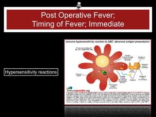 post operative fever infectious and non- | PDF