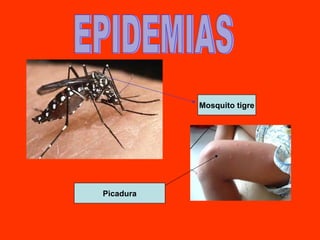EPIDEMIAS Mosquito tigre Picadura 