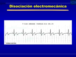 Disociación electromecánica 