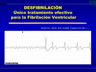 DESFIBRILACIÓN  Único tratamiento efectivo  para la Fibrilación Ventricular 300 JOULES  DEFIB  20:29  01APR96  PADDLES X1.0  HR = --- 