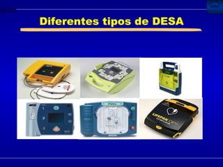 Diferentes tipos de DESA 