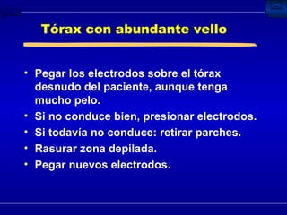 Tórax con abundante vello Pegar los electrodos sobre el tórax desnudo del paciente, aunque tenga mucho pelo. Si no conduce bien, presionar electrodos. Si todavía no conduce: retirar parches. Rasurar zona depilada. Pegar nuevos electrodos. 