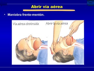Abrir vía aérea Maniobra frente-mentón. 