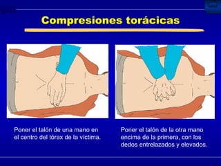 Compresiones torácicas Poner el talón de la otra mano encima de la primera, con los dedos entrelazados y elevados. Poner el talón de una mano en el centro del tórax de la víctima. 